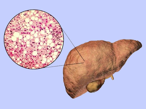 Dra. Viridiana Rodríguez Granados Especialista en Gastroenterología y Hepatología