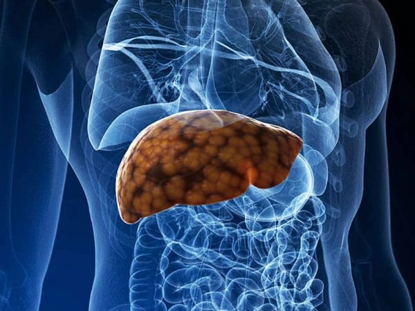 Dra. Viridiana Rodríguez Granados Especialista en Gastroenterología y Hepatología